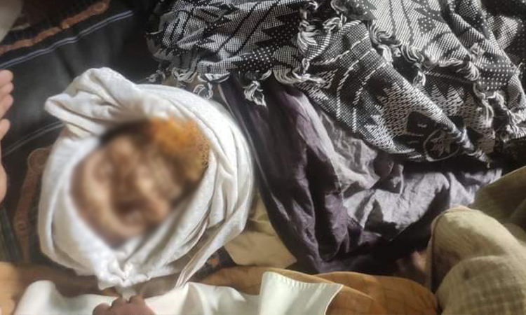 মহেশখালীতে সাবেক মেম্বারকে পিটিয়ে হত্যা