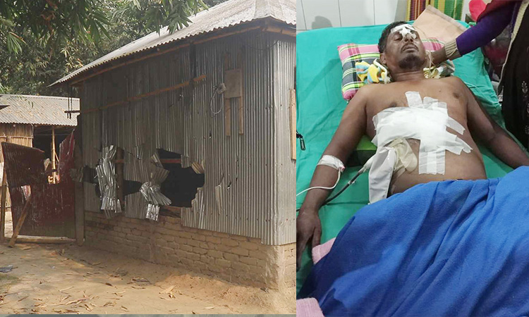 দৌলতপুরে নির্বাচনি সহিংসতা, বোমায় আহত তুফানের মৃত্যু