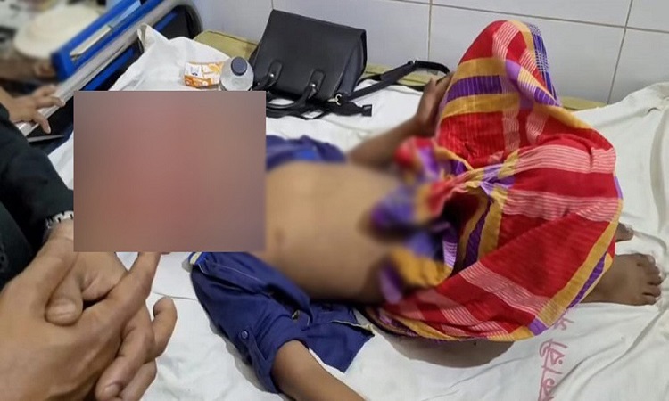 খৎনার সময় শিশুর অতিরিক্ত রক্তপাত, পালালো ডাক্তার