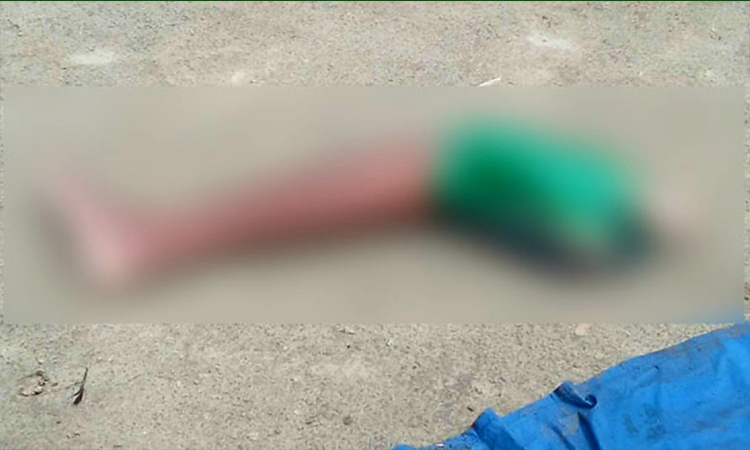 রাজশাহীতে ড্রেন থেকে কাটা পা উদ্ধার