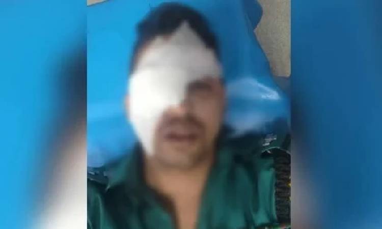 হিজড়াদের হামলায় চোখ হারালেন এসআই