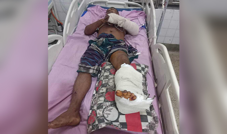 রাজবাড়ীতে দুর্বৃত্তদের হাতে গ্রাম পুলিশ গুলিবিদ্ধ