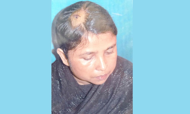 লামায় যৌতুকের দাবিতে নির্যাতিত ৪ সন্তানের জননী