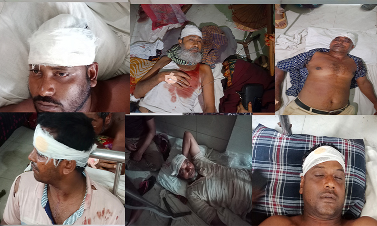 কোটচাঁদপুরে জমি দখল কেন্দ্র করে দু’পক্ষের সংঘর্ষ, আহত ৭