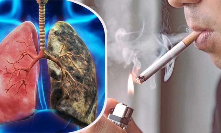 ক্যান্সারের জন্য দায়ী সিগারেটের ৭২ রকম রাসায়নিক