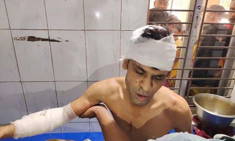 রায়পুরায় সাংবাদিককে গুলি ও হাতুড়ি দিয়ে পিটিয়ে আহত