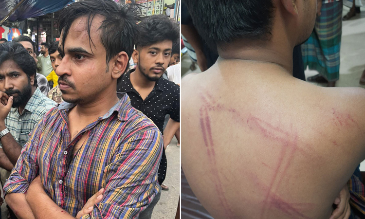সিন্ডিকেটের প্রতিবাদ করায় সাংবাদিককে পেটাল বিএনপি নেতার অনুসারীরা