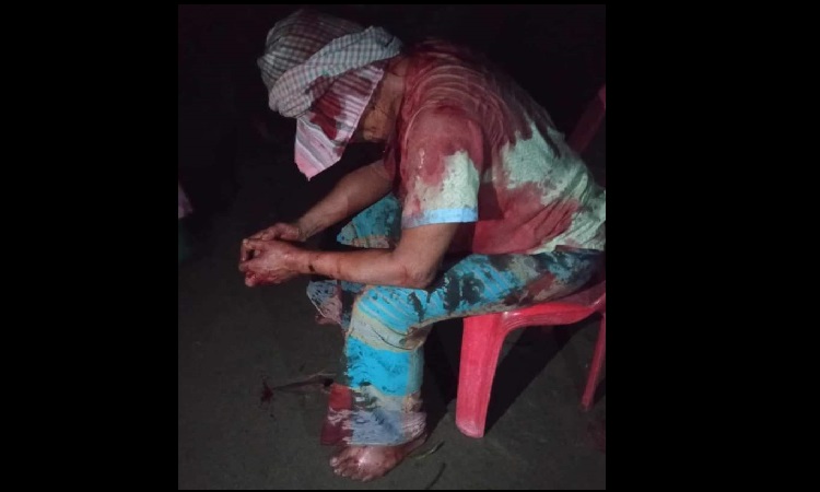 বীর মুক্তিযোদ্ধা খগেন্দ্র নাথ প্রমানিক দুবৃর্ত্তদের হামলায় গুরুতর আহত