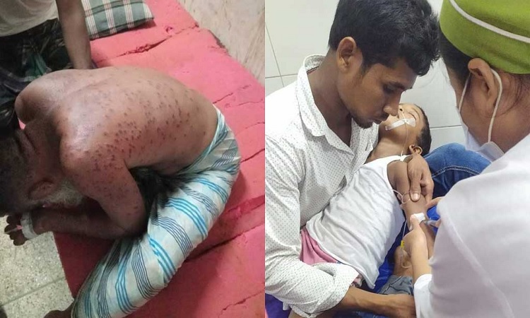 ভিমরুলের কামড়ে বাবা-মেয়ের পর ছেলেরও মৃত্যু