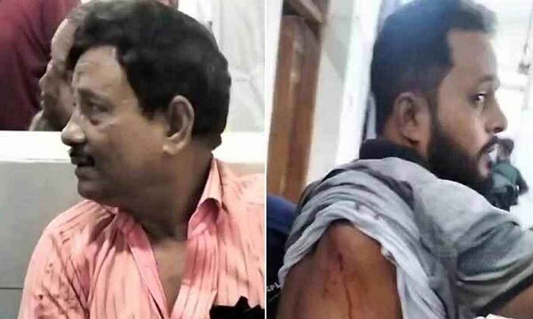 মোহাম্মদপুরে কাঁচাবাজার কমিটির সভাপতি ও তার ভাই গুলিবিদ্ধ