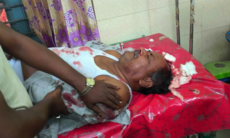 কালীগঞ্জে বিএনপি নেতাকে কুপিয়ে জখম