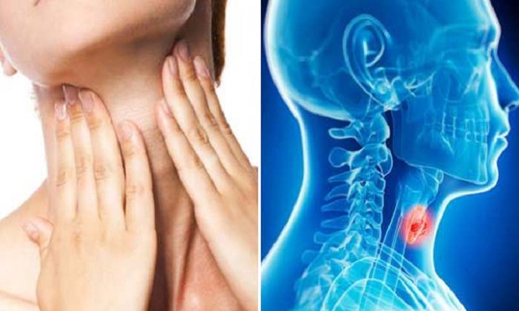 গলায় ক্যান্সার: যেসব লক্ষণে সতর্ক হওয়া জরুরি