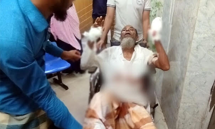 বাড়ি দখল করতে বাবার হাত-পা ভেঙে  দিল ছেলে