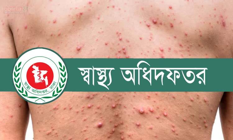 ২৪ ঘণ্টায় হামে ঝরল আরও ১১ শিশুর প্রাণ