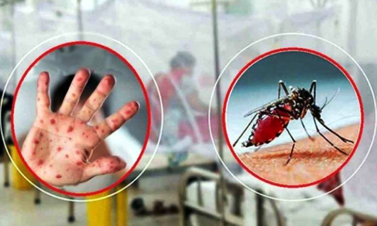 ২৪ ঘণ্টায় হাম উপসর্গে ৫ ও ডেঙ্গুতে ৩ জনের মৃত্যু
