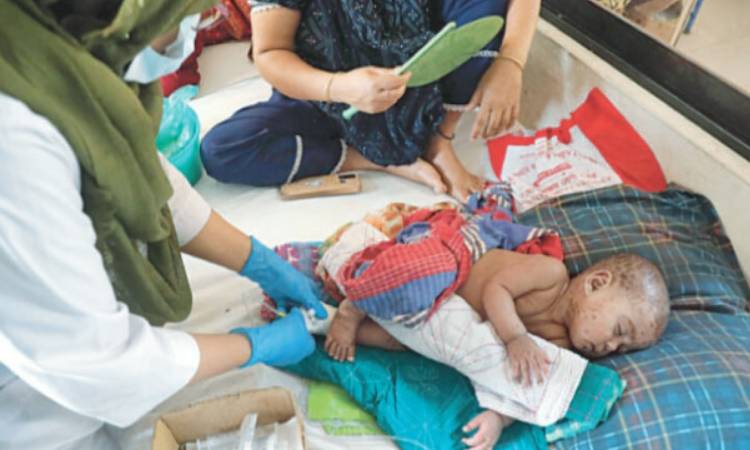 হামের উপসর্গে একদিনে আরও ৪ শিশুর মৃত্যু