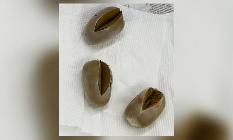 শাহজালালে যাত্রীর শরীরে লুকানো ছিল ৩ ‘সোনার ডিম’