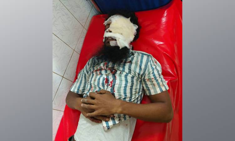 মোবাইল ফোনে গেম খেলার সময় বিস্ফোরণ, ২ যুবক আহত